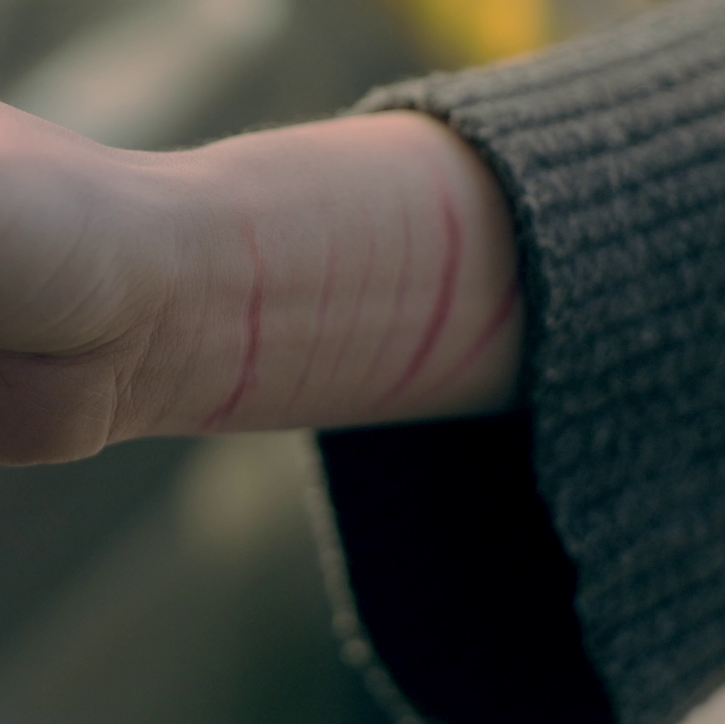 Sebepoškozování není „touha po pozornosti“.